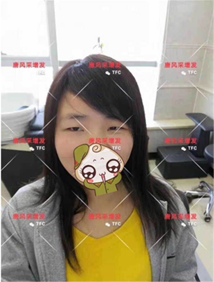 蓋白發(fā)假發(fā) \