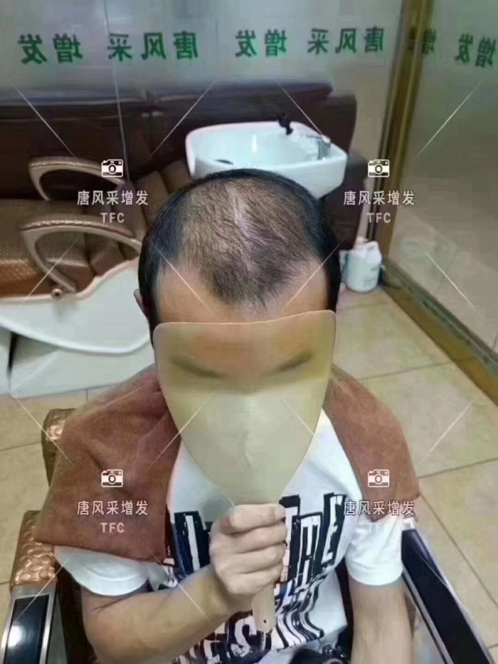 真發(fā)短假發(fā) \