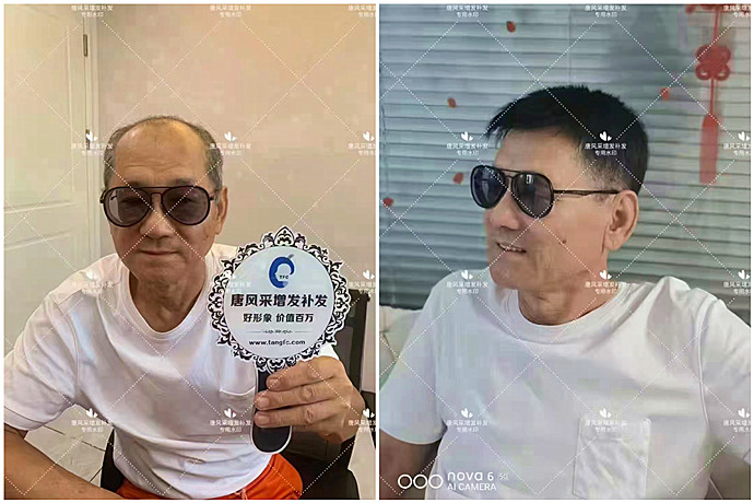 中年人假發(fā)套 \