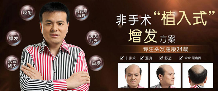 值得買的真人頭發(fā)假發(fā) \