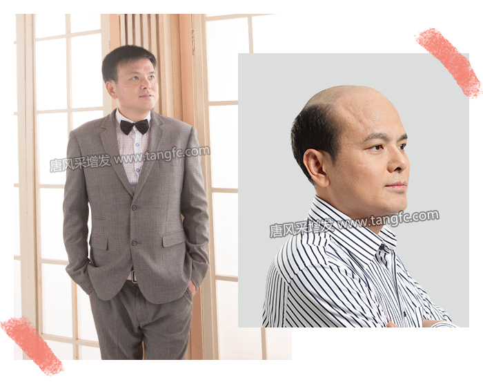 用自己頭發(fā)做假發(fā) \