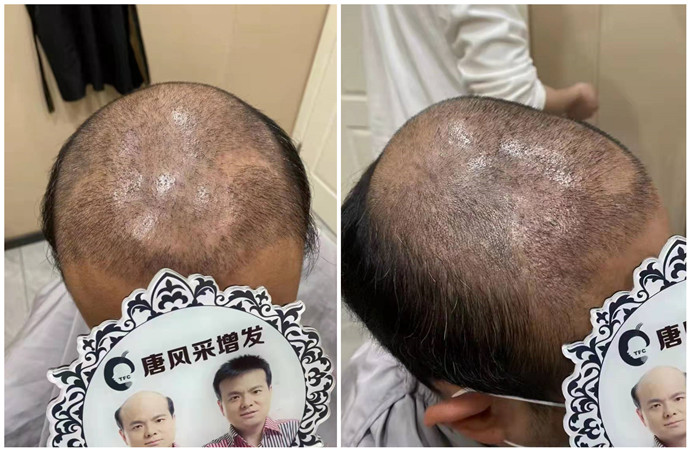 男人 定做假發(fā) \