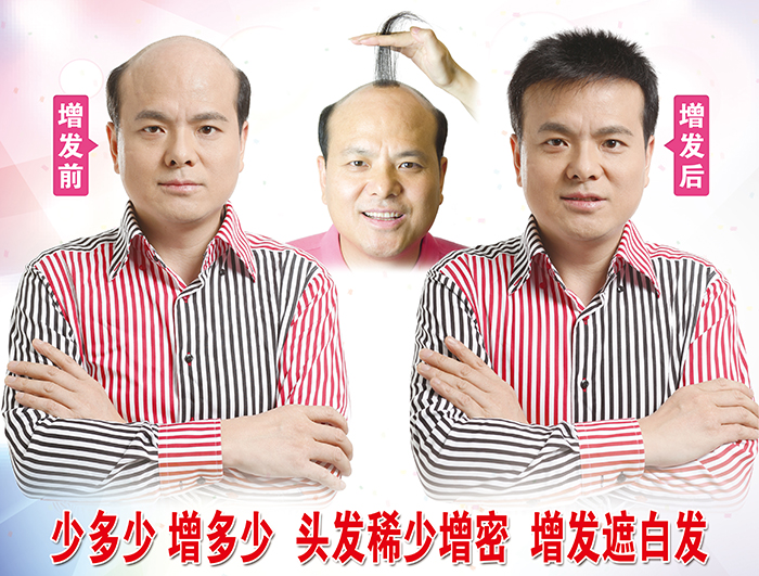 真發(fā)假發(fā)專賣店推薦 \