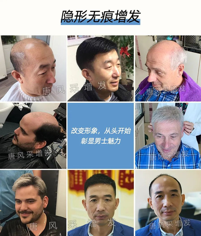 男士頭頂假發(fā)片效果好嗎 \