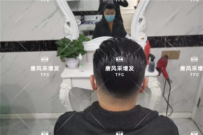 男士頭頂假發(fā)片效果好嗎 \