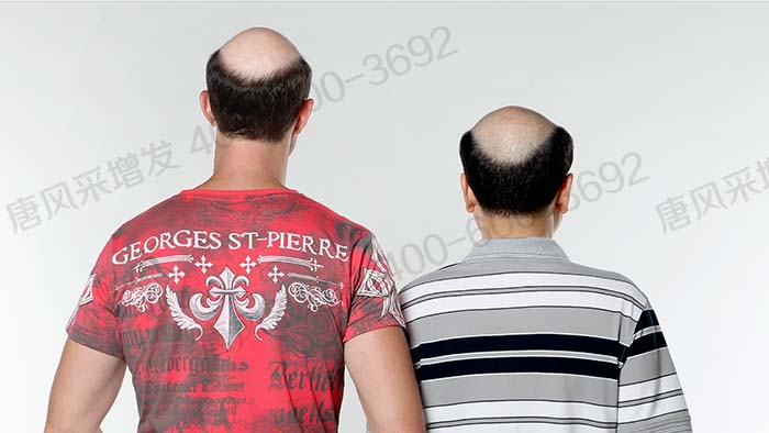 男士假發(fā)定制要多久時(shí)間 \