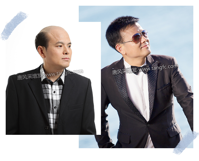 遮禿補(bǔ)發(fā)假發(fā)片 \