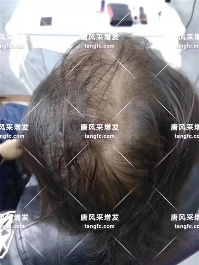 男士永久假發(fā) \