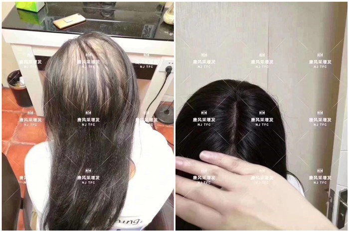 高檔女假發(fā) \