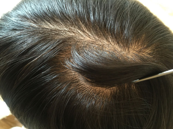 高檔女假發(fā) \