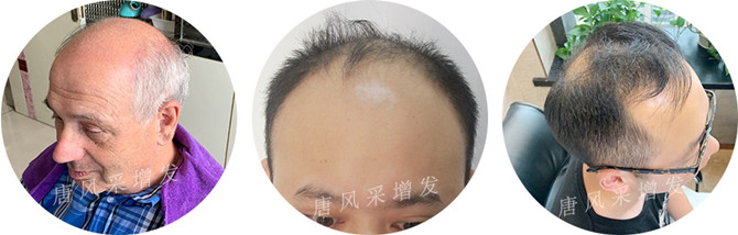 唐風(fēng)采隱形補發(fā) \