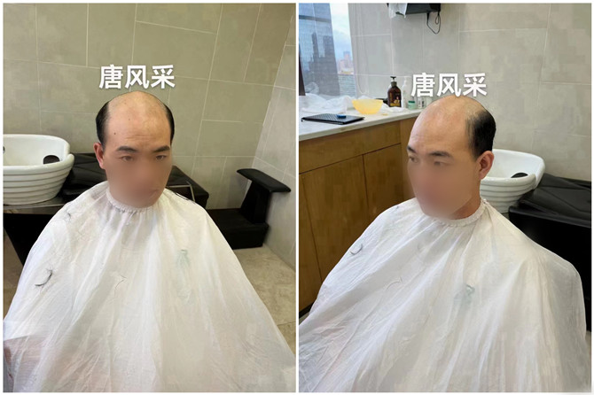 男士增發(fā)補(bǔ)發(fā)實(shí)體店 \