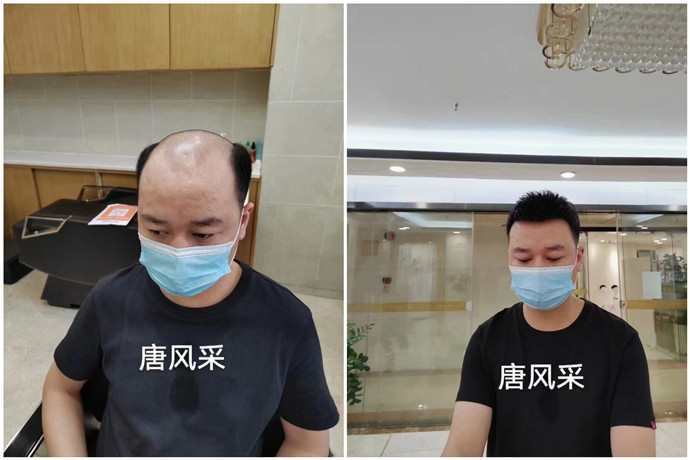 定制男假發(fā) \