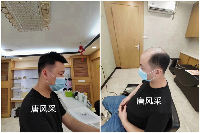 定制男假發(fā) \