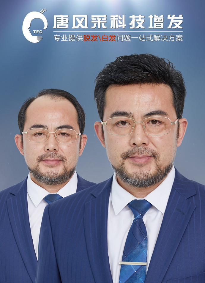 男假發(fā)定制 \