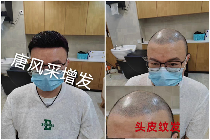 哪里可以定做真人假發(fā) \