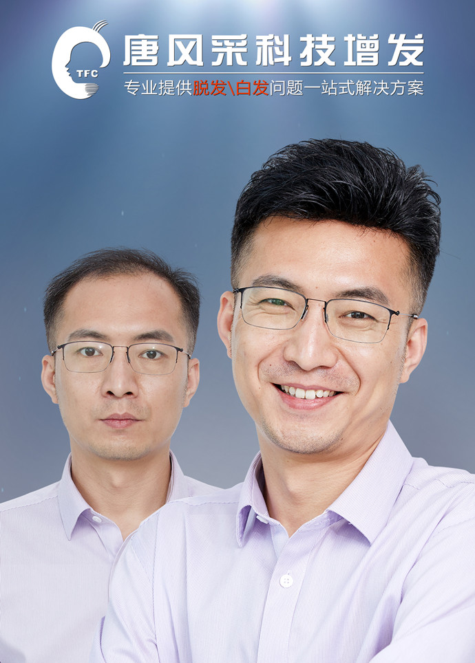 哪里可以定做真人假發(fā) \