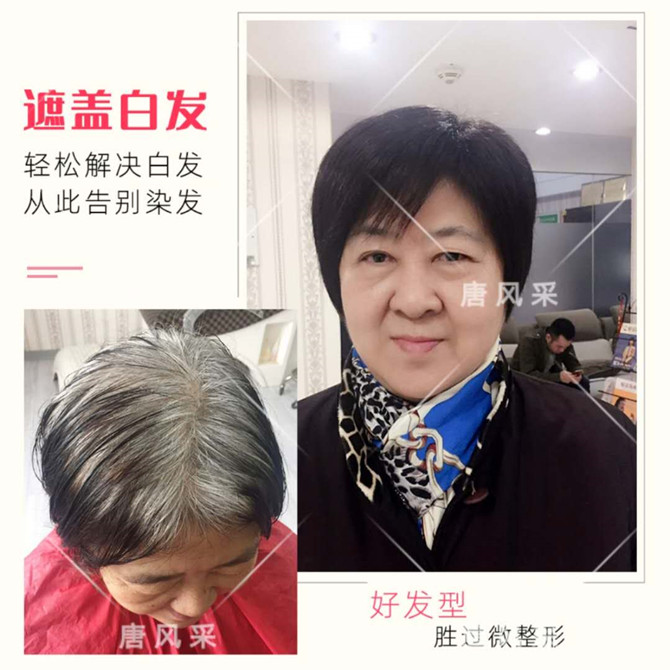 唐風(fēng)采定制局部假發(fā) \