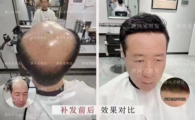 適合四五十歲男士的假發(fā) \