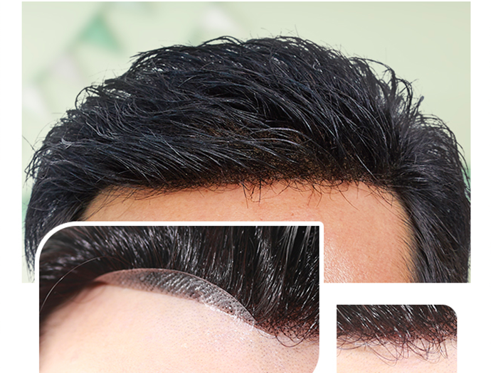 禿頭假發(fā)片 \