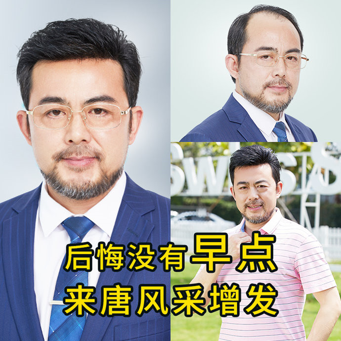 禿頭假發(fā)片 \