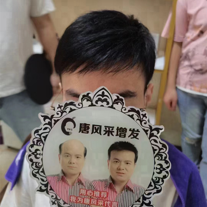 禿頭假發(fā)片 \