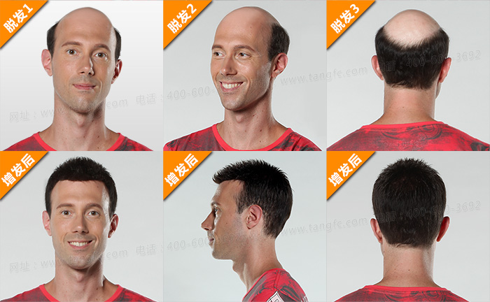 織發(fā)假發(fā) \