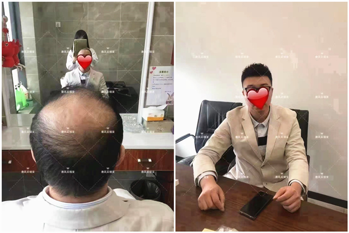 假發(fā)可以做平頭嗎 \