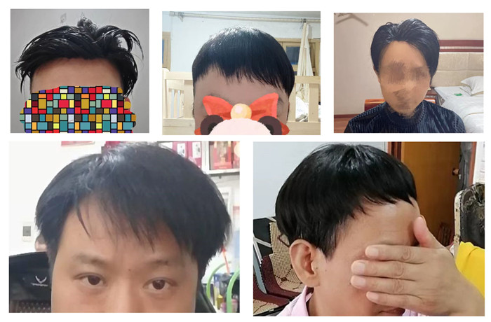 織發(fā)假發(fā) \