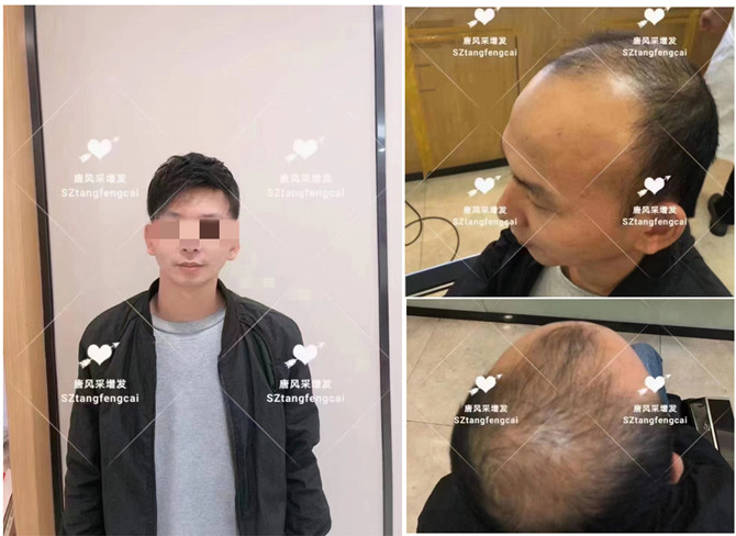 假發(fā)可以做平頭嗎 \