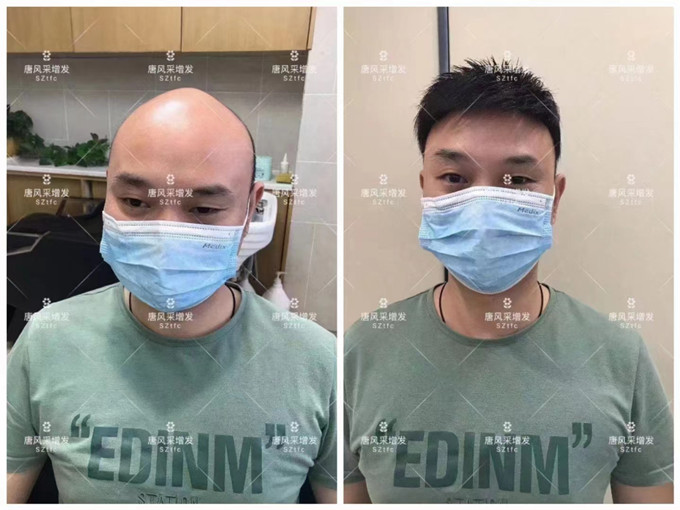 品牌男士假發(fā) \