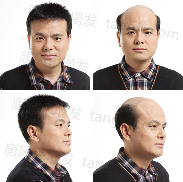 品牌男士假發(fā) \