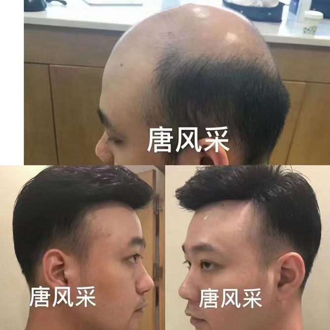 假發(fā)定做實體店 \