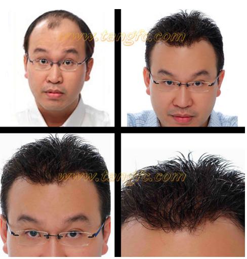 仿真男士補(bǔ)發(fā) \