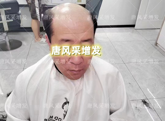 仿真男士補(bǔ)發(fā) \