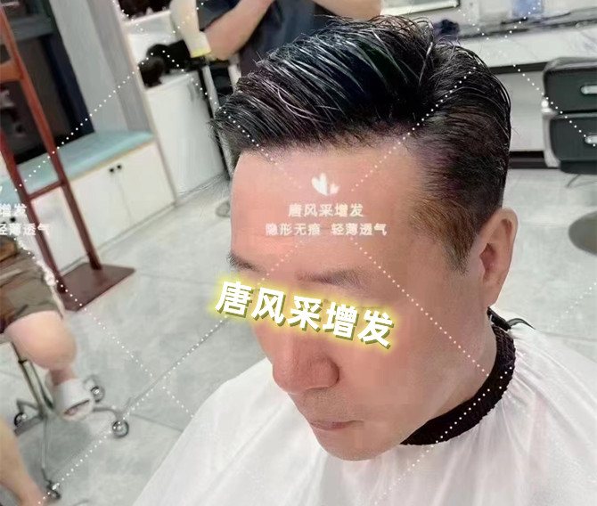 仿真男士補(bǔ)發(fā) \