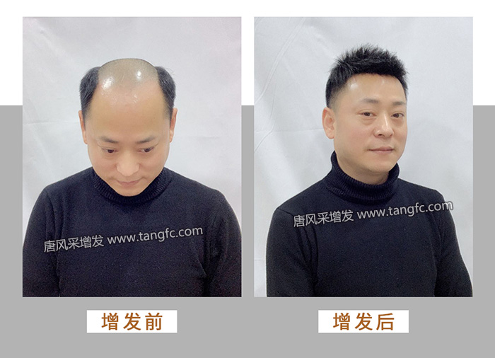 3000塊的假發(fā) \