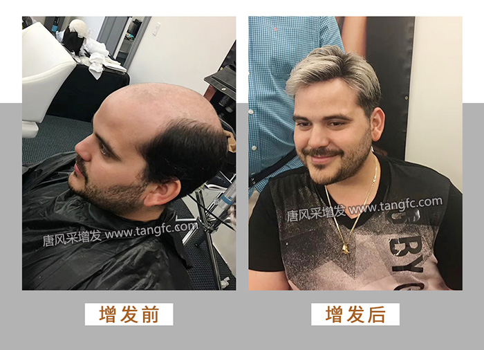 3000塊的假發(fā) \