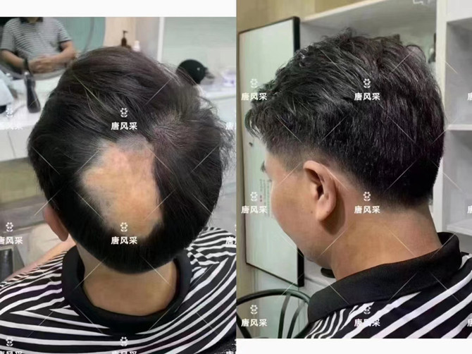 仿真頭發(fā)假發(fā)片 \