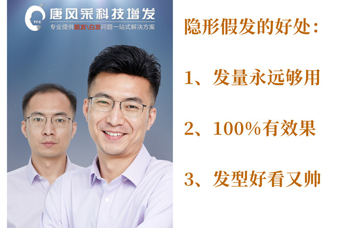 假發(fā)片怎么買(mǎi) \