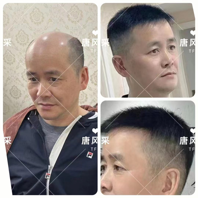 男人戴假發(fā)能看出來嗎 \