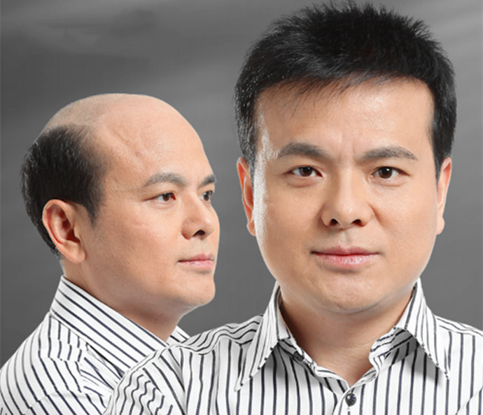 男士真發(fā)假發(fā)在哪可以定做 \