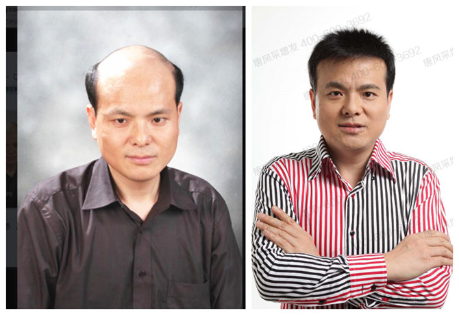 假發(fā)套怎么選 \