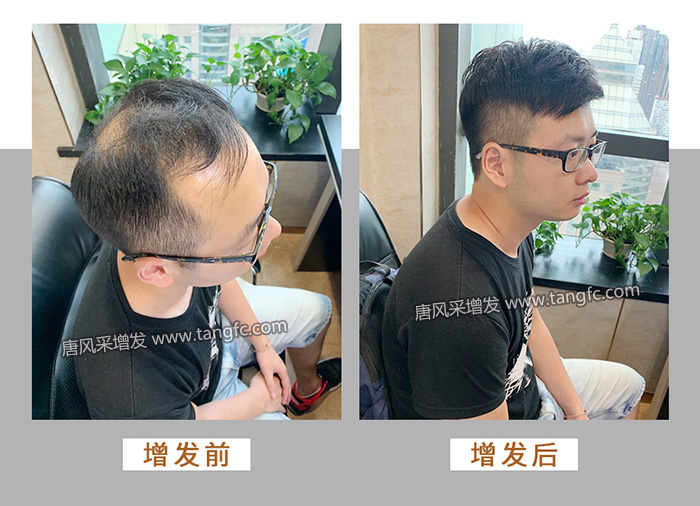 男士購買假發(fā) \