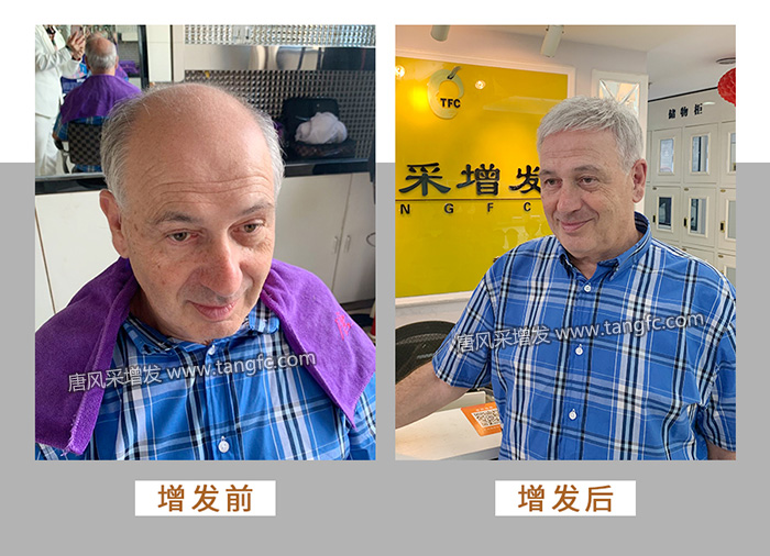 假發(fā)套怎么選 \