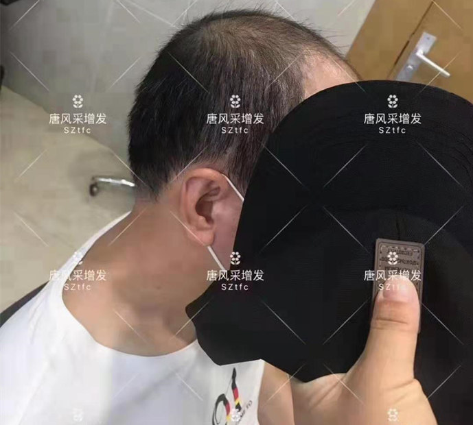 男士買假發(fā) \