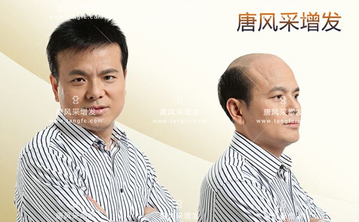 男士真人發(fā)假發(fā) \