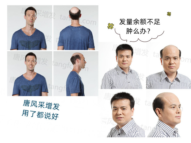 男士真人發(fā)假發(fā) \