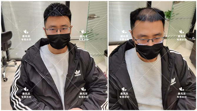 男士真人發(fā)假發(fā) \