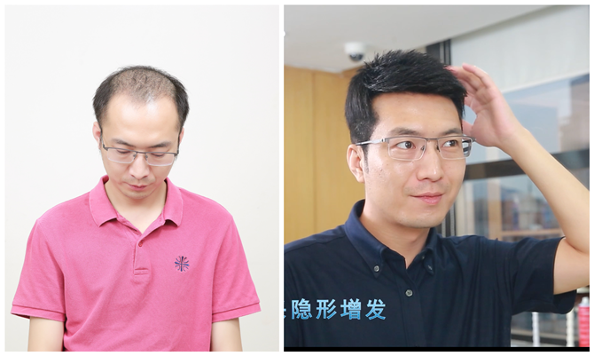 男士假發(fā)專賣店哪家好 \